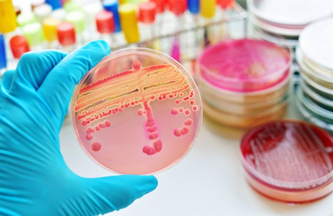 Estandarización y aseguramiento de la Calidad en Microbiología- con enfoque a bacteriología 